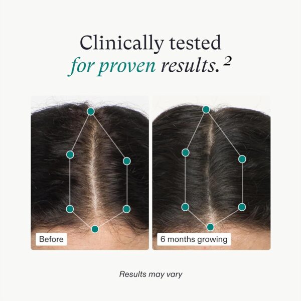 nutrafol women’s hair growth supplements, ages 18 44, clinically proven for visibly thicker and stronger hair, dermatologist recommended – 1 month supply